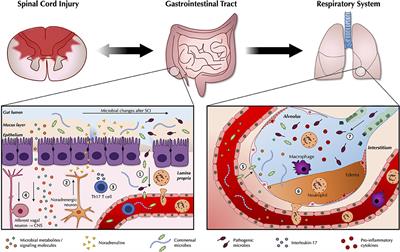 Traumatic Spinal Cord Injury and the Gut Microbiota: Current Insights and Future Challenges